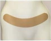 Oleeva 37CS C Section Scar Shape.