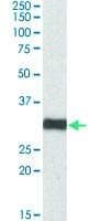 PAB19028 - Size : 100 micrograms - Anti-ETFA Goat Polyclonal Antibody - Each (100micrograms)