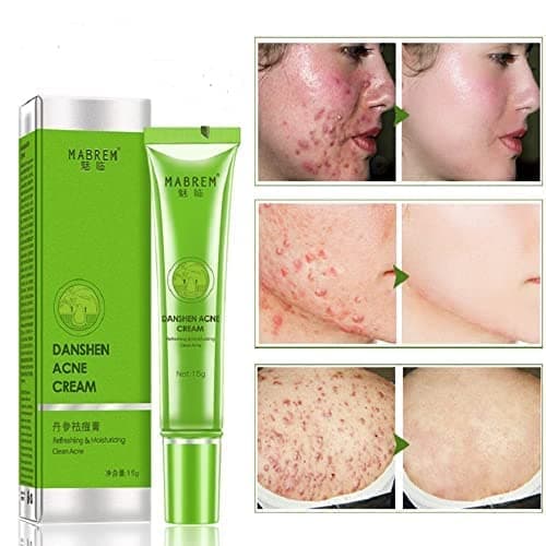 Dark Spot Corrector, Dark Spot Remover for Face and Body - Herbal Natural moisturizing Cream for Acne and Pimple Spots