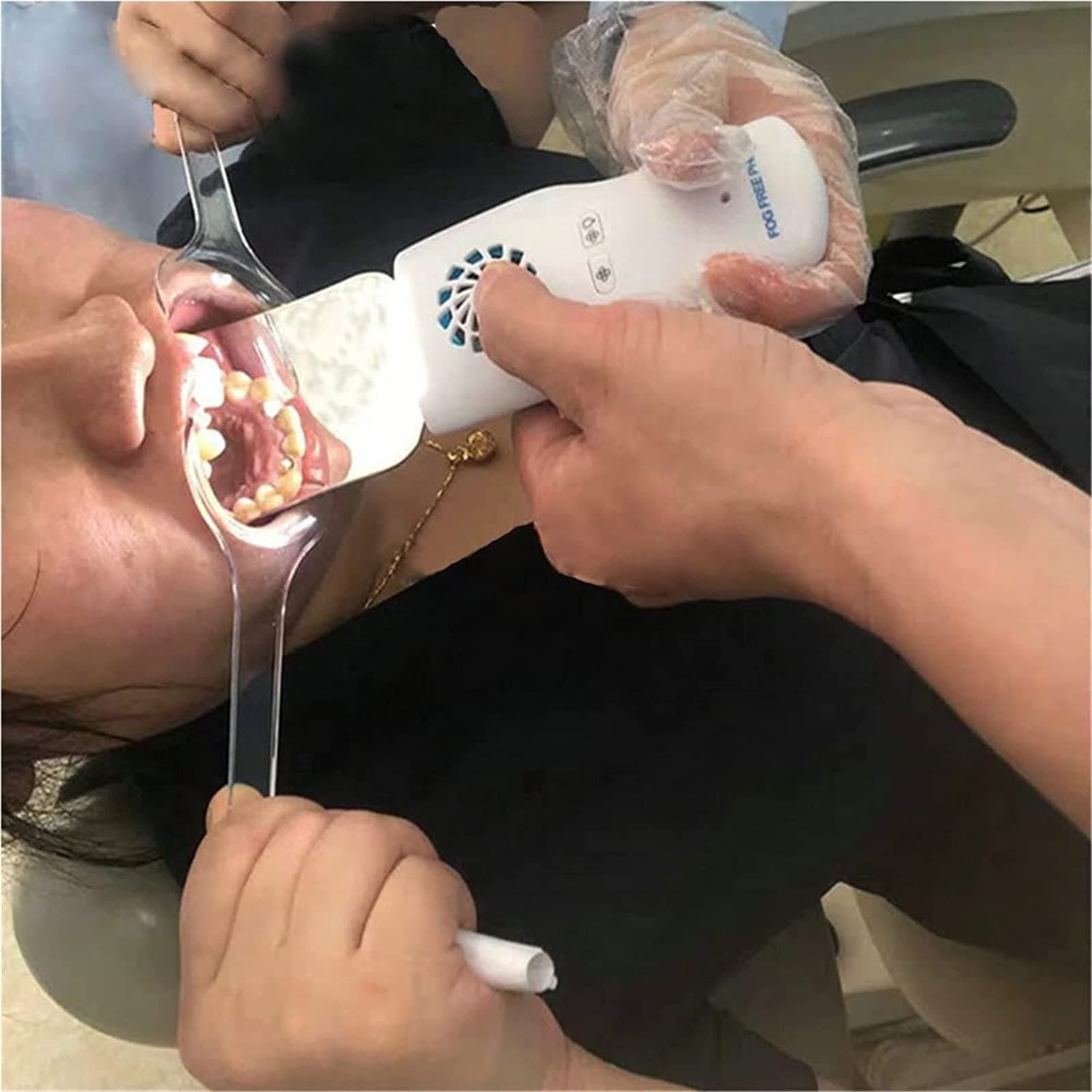 Dental Oral Anti-Fog Photography Mirrors, Electronic Intraoral Mirrors with Handle, Dental Care Kits, LED Lighting Orthodontics Mirror Dental Double-Sided Imaging Device