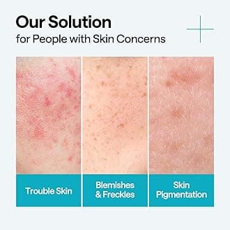 MEDIHEAL OFFICIAL MADECASSOSIDE BLEMISH REPAIR SERUM 1.4 fl oz (40 ml), Infused Beauty Serum, Rash Prevention Care