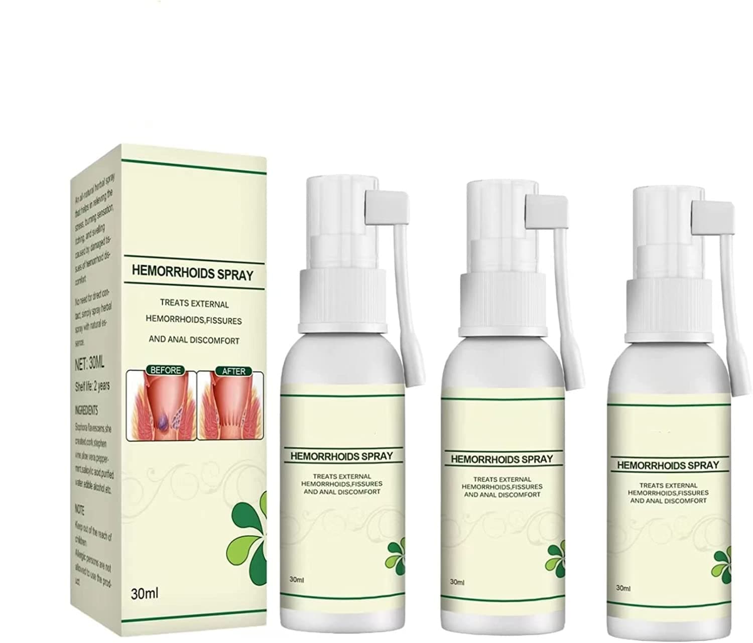 MING ZHEN Korean Natural Herbal Hemorrhoids Spray, 2022 Newpain Itch Relief Hemmoroids Treatment Removal Spray