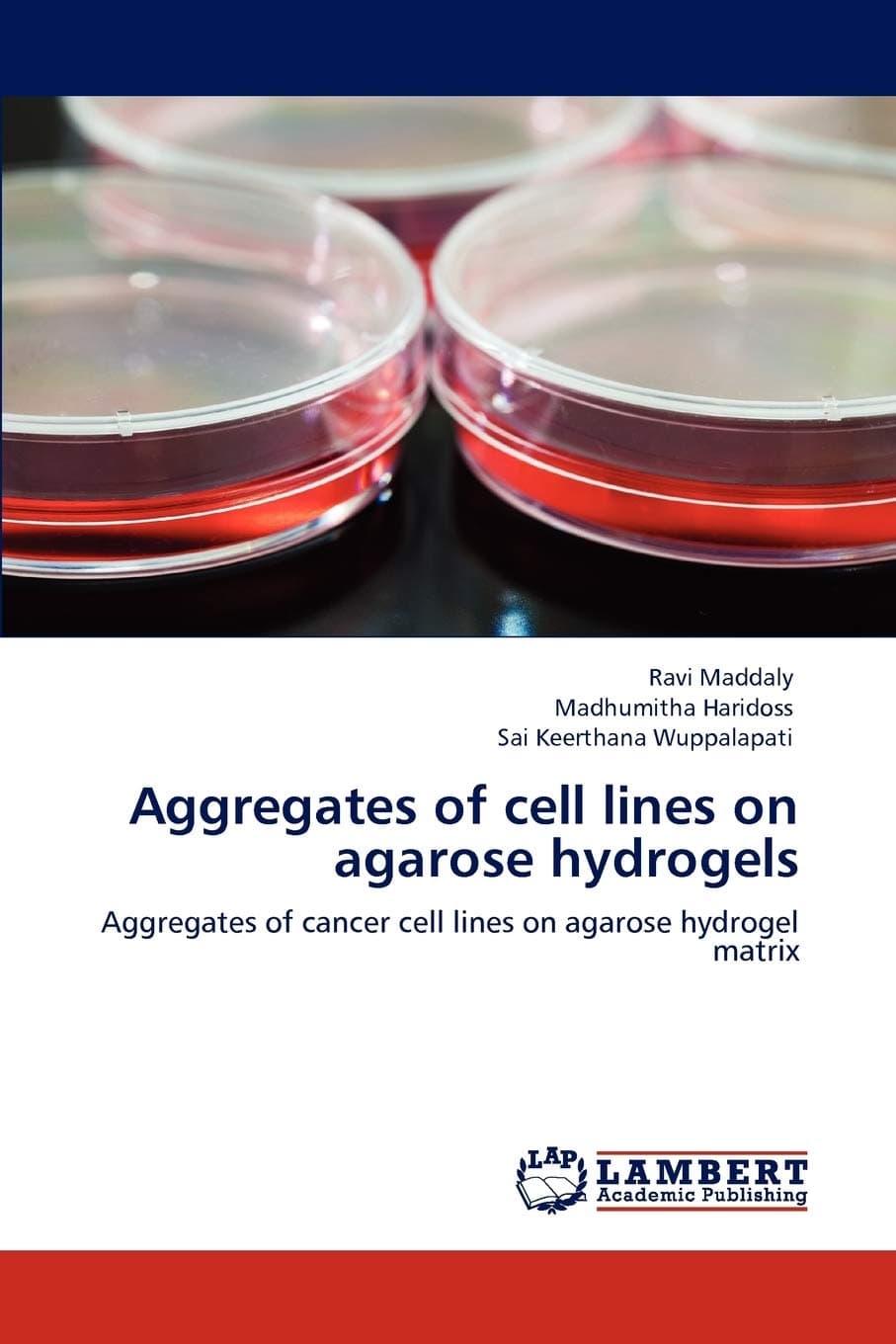 Aggregates of cell lines on agarose hydrogels: Aggregates of cancer cell lines on agarose hydrogel matrix Paperback – January 17, 2012