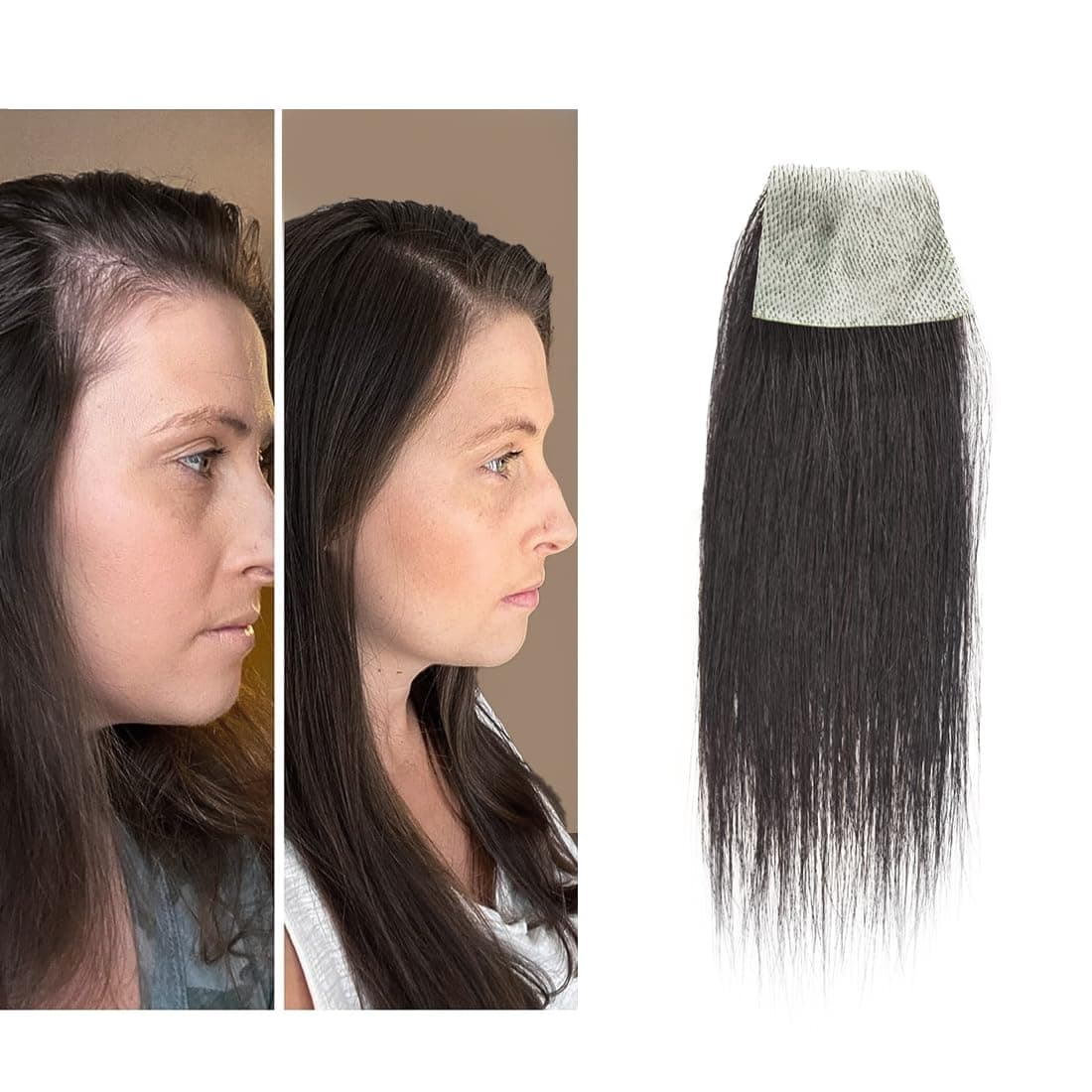 scar human hair replacement Accidental burns without hair for men women Hairline Loss Straight Tape in Replacement Toupee (Natural Black, 1.57"x1.57")