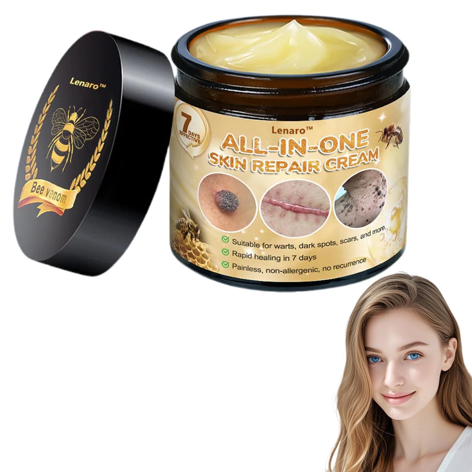 Bee Venom All-in-One Cream,Bee Venom Skin Treatment Cream,Hydrates skin and reduces blemishes (1PC)