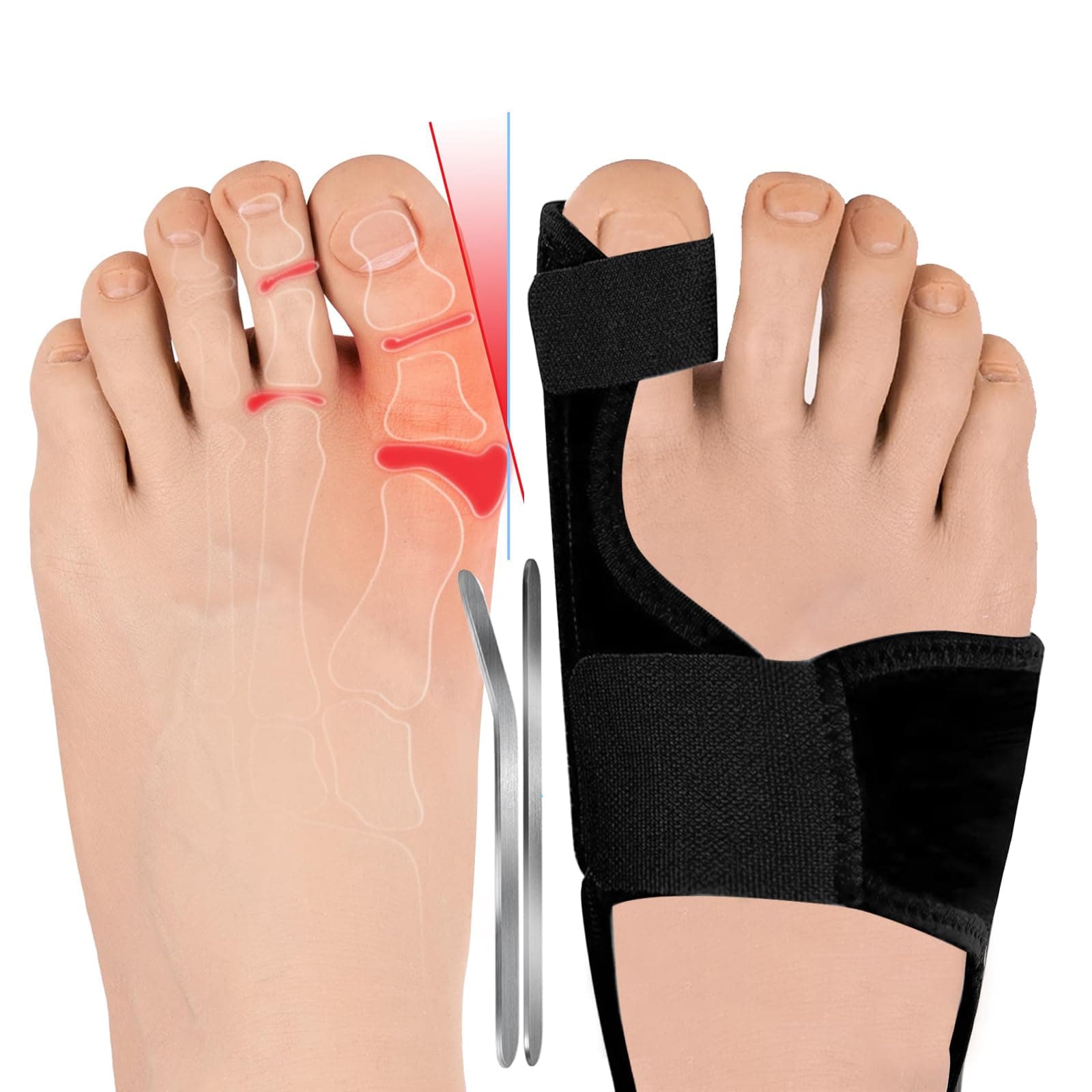 LINXIUBunion Corrector for Women Men Big Toe Straightener Adjustable Bunion Splint Brace Hallux Valgus Correction Orthopedic Sleeve for Day Night Support 2 Pcs