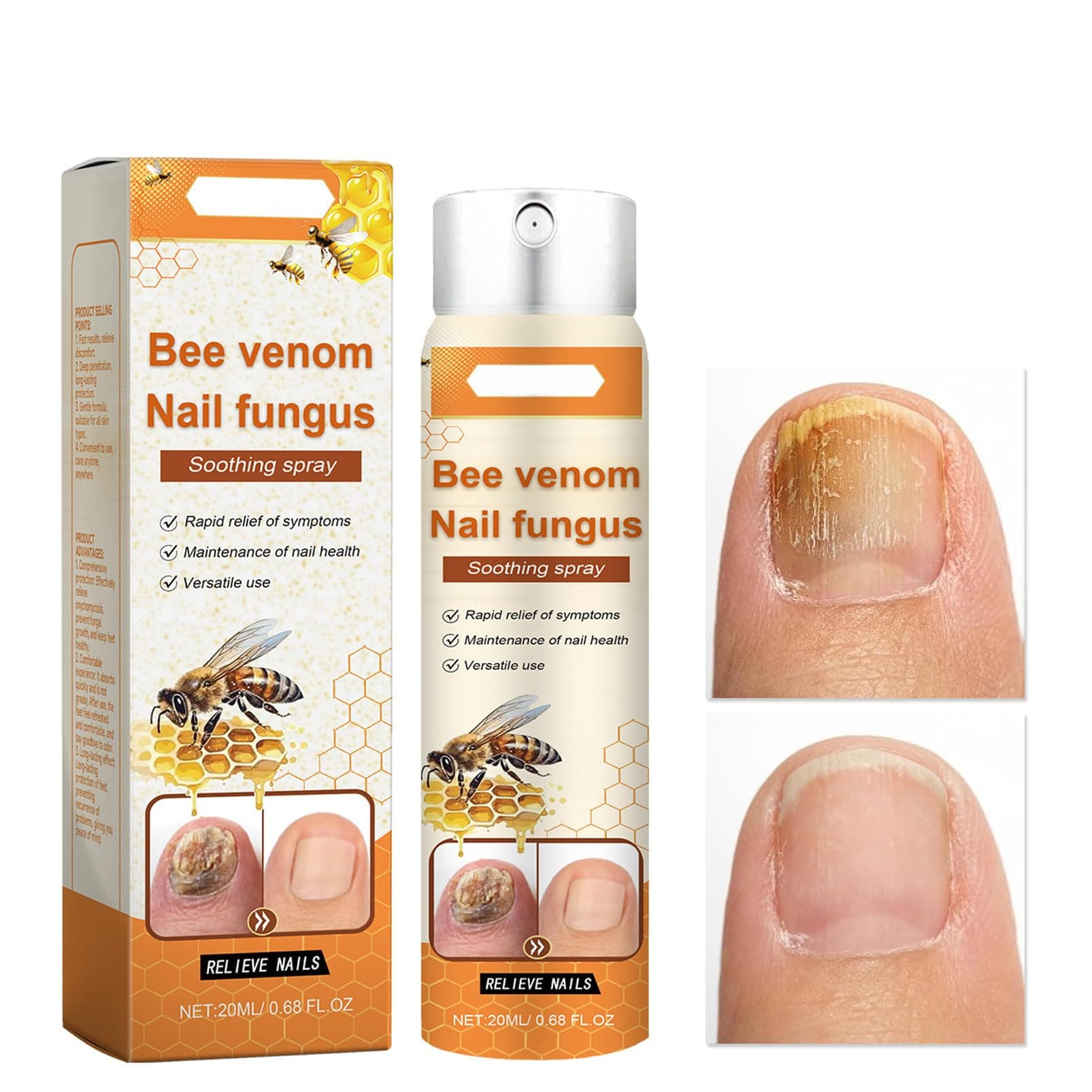 – Bee Venom Nail Fungus Soothing Spray for Toenail, Bee Venom Nail Fungal Treatment, Nail Strengthener for Damaged Nails, Bee Venom Nail Treatment Serum, Effective Nail Repair Treatment