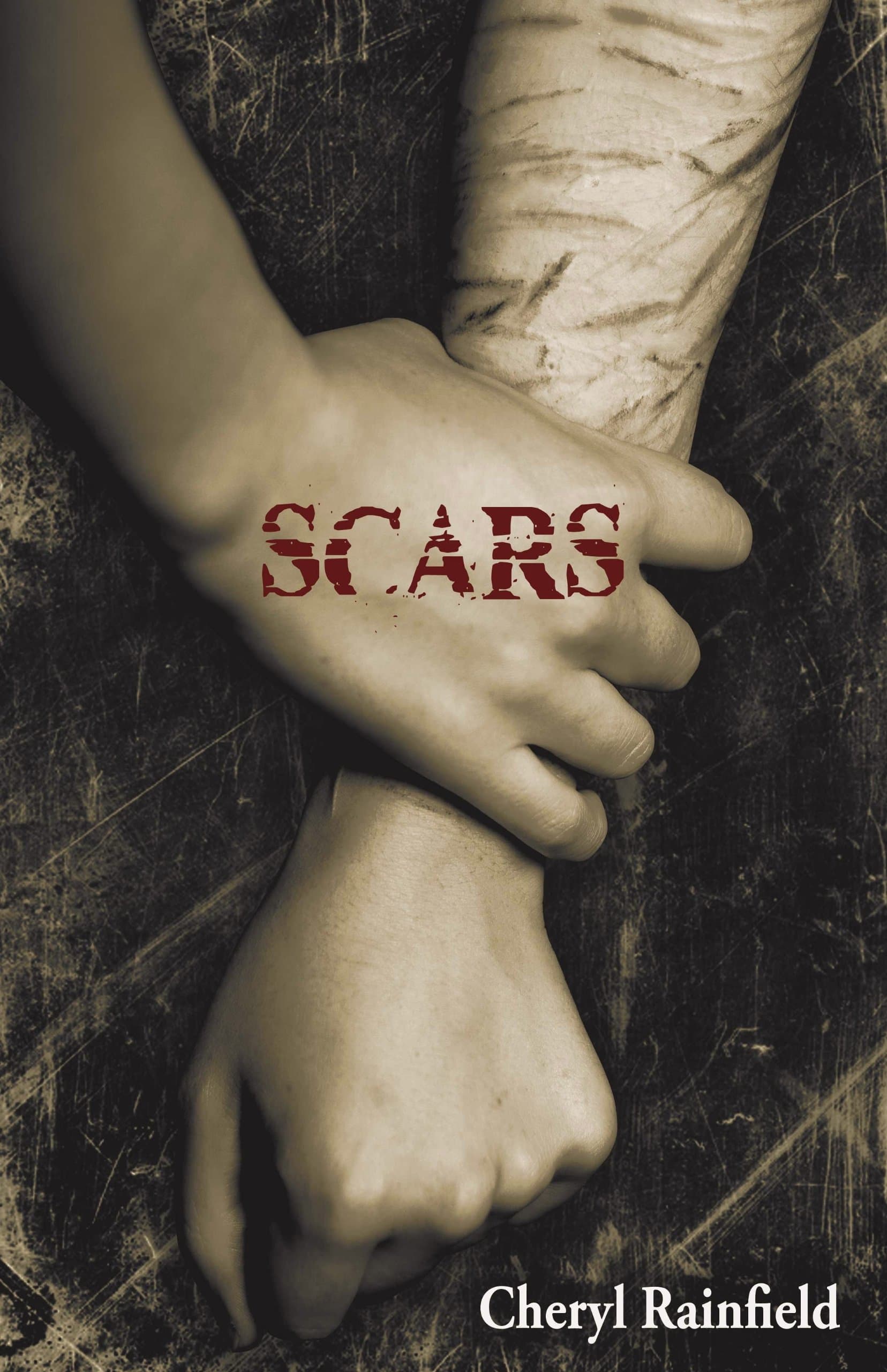 Scars Paperback – May 31, 2011