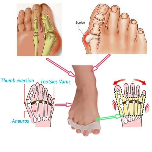 Elastic Gel Toe Separators, Bunion Pain Relief Toe Straightener, Toe Spacers Rubber Toe Stretchers Used for Sports Activities Yoga Practice Running for Women Men (1-pairs)