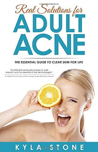 Real Solutions for Adult Acne: Cure Hormonal Acne with Science-Backed Treatments that Work