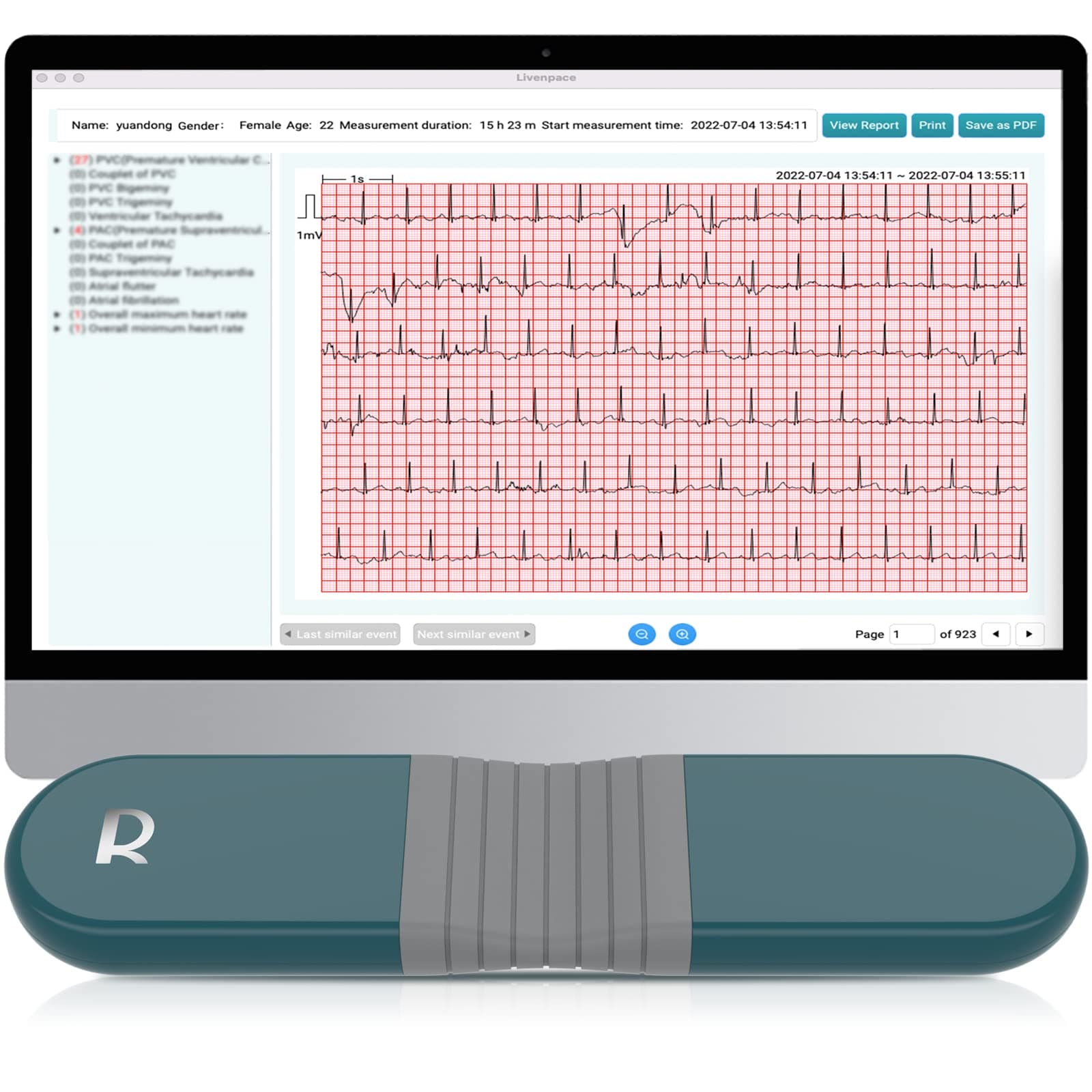 Livenpace AI HR Monitor, E K G Monitor, 24 Hours Chest Lead Device with Free AI Analysis & PC Report, Chargeable Recorder, HHM1